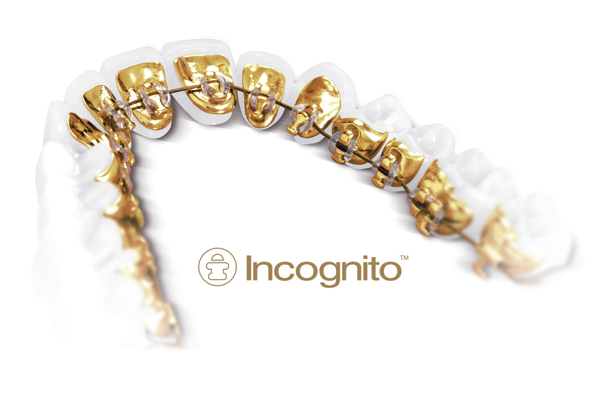 Why choose Incognito Braces in 2019?